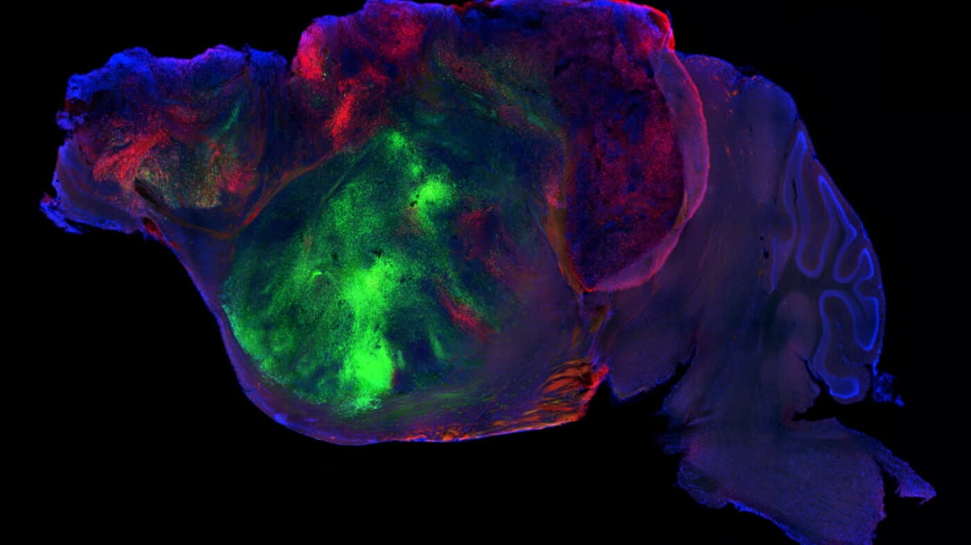 Cerebro de ratón con fibras nerviosas del injerto humano en color